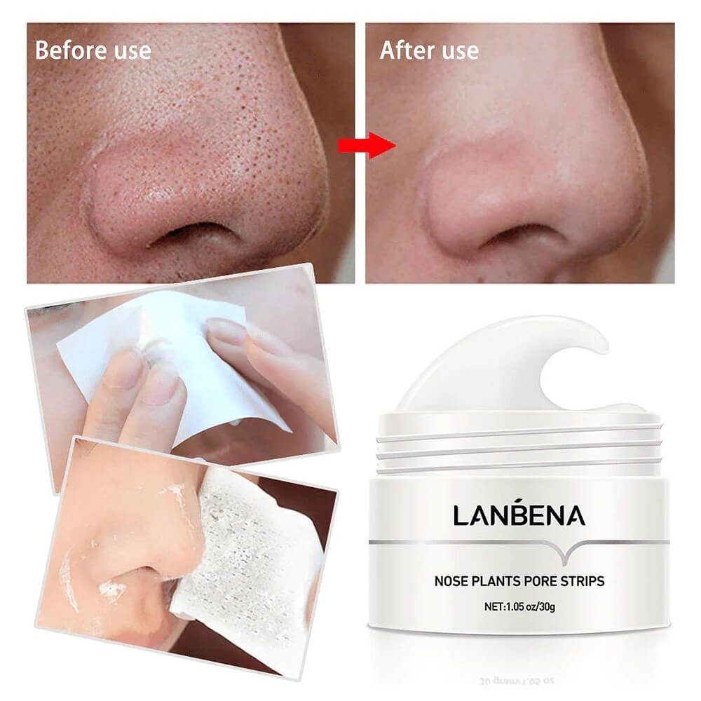 Blackhead Removal Facial Mask