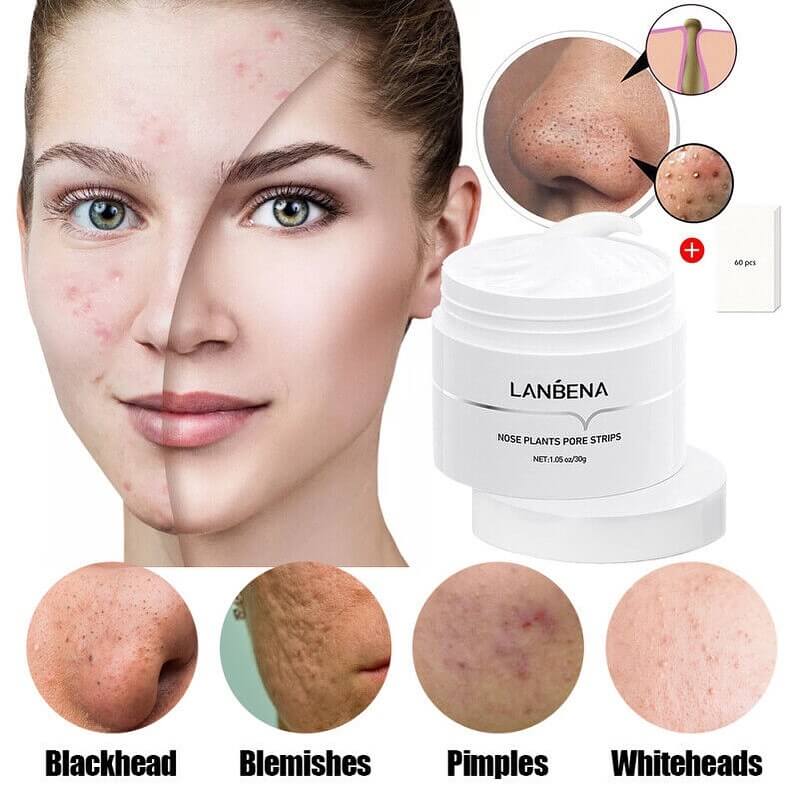 Blackhead Removal Facial Mask