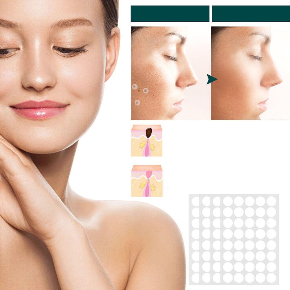 Blemish and Wart Removal Patches