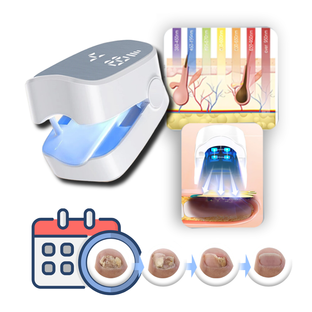 Painless Nail Fungus Laser Treatment Device
