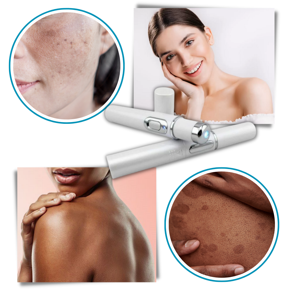Portable Laser Therapy for a Brighter Complexion